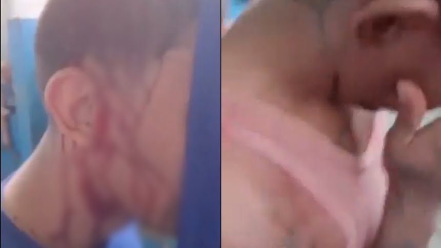 Impactante Video: Presos en Guárico Agredidos Durante Huelga de Hambre